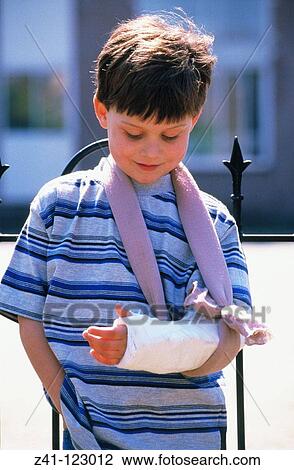 Boy with broken arm View Large Photo Image Stock Image - Boy with broken arm. Fotosearch