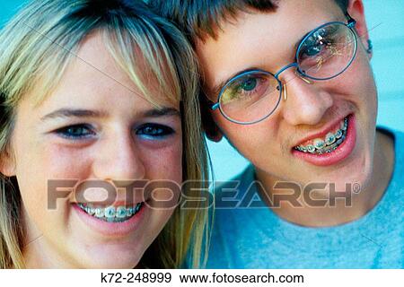 braces View Large Photo Image Stock Photo - braces. Fotosearch