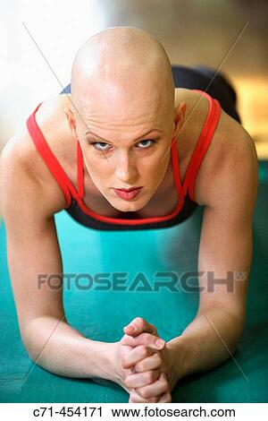 Caucasian Woman with alopecia areata/cancer survivor working out at the gym View Large Photo Image Stock Image - Caucasian Woman with alopecia areata/cancer survivor working out at the gym. Fotosearch