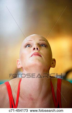 Caucasian Woman with alopecia areata/cancer survivor working out at the gym View Large Photo Image Stock Image - Caucasian Woman with alopecia areata/cancer survivor working out at the gym. Fotosearch