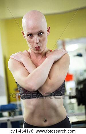 Caucasian Woman with alopecia areata/cancer survivor working out at the gym View Large Photo Image Stock Photograph - Caucasian Woman with alopecia areata/cancer survivor working out at the gym. Fotosearch