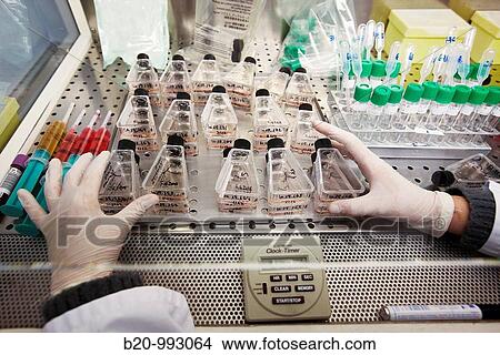 Cell culture, Laboratory of genetics, Cytogenetics. Hospital Policlinica Gipuzkoa, San Sebastian, Donostia, Euskadi, Spain View Large Photo Image Picture - Cell culture, Laboratory of genetics, Cytogenetics. Hospital Policlinica Gipuzkoa, San Sebastian, Donostia, Euskadi, Spain. Fotosearch