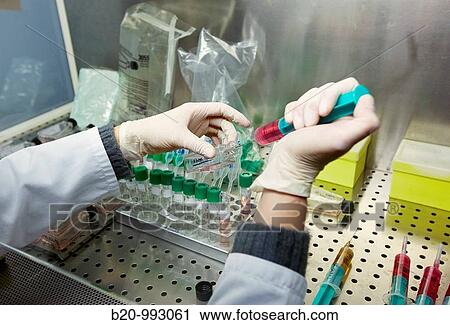 Stock Image - Cell culture, Laboratory of genetics, Cytogenetics. Hospital Policlinica Gipuzkoa, San Sebastian, Donostia, Euskadi, Spain. Fotosearch