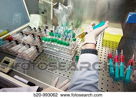 Stock Image - Cell culture, Laboratory of genetics, Cytogenetics. Hospital Policlinica Gipuzkoa, San Sebastian, Donostia, Euskadi, Spain. Fotosearch