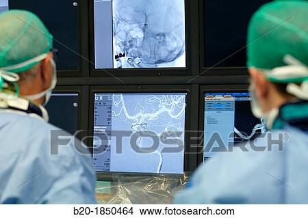Cerebral aneurysm embolization, Interventional Neuroradiology, Radiology Department, Donostia Hospital, San Sebastian, Donostia, Gipuzkoa, Basque Country, Spain View Large Photo Image Picture - Cerebral aneurysm embolization, Interventional Neuroradiology, Radiology Department, Donostia Hospital, San Sebastian, Donostia, Gipuzkoa, Basque Country, Spain. Fotosearch