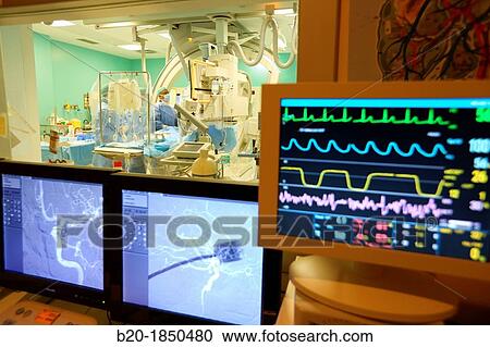 Stock Image - Cerebral aneurysm embolization, Willis polygone Angiography, Interventional Neuroradiology, Radiology Department, Donostia Hospital, San Sebastian, Donostia, Gipuzkoa, Basque Country, Spain. Fotosearch