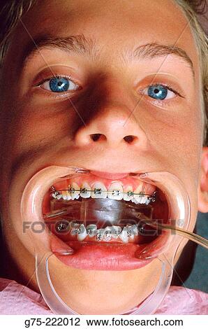 Children View Large Photo Image Stock Image - Children. Fotosearch