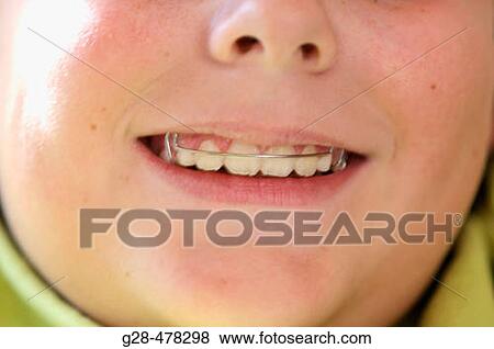 Children View Large Photo Image Stock Photo - Children. Fotosearch