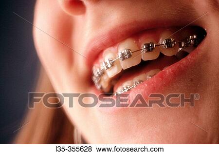 Stock Photo - Children. Fotosearch