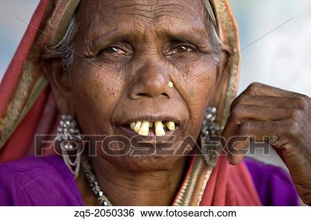 Close up of a Korku tribal women with buck teeth, Khalwa, Jharikheda village, Madhya Pradesh, India. Korku is a scheduled tribe ST community predominantly found in Madhya Pradesh and some parts of Maharasthra. View Large Photo Image Stock Photograph - Close up of a Korku tribal women with buck teeth, Khalwa, Jharikheda village, Madhya Pradesh, India. Korku is a scheduled tribe ST community predominantly found in Madhya Pradesh and some parts of Maharasthra.. Fotosearch