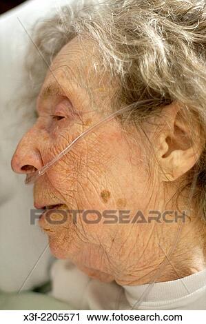 Close-up of mom age 97 recovering in hospital after fall in her assisted living complex. Fergus Falls Minnesota MN USA. View Large Photo Image Stock Image - Close-up of mom age 97 recovering in hospital after fall in her assisted living complex. Fergus Falls Minnesota MN USA.. Fotosearch