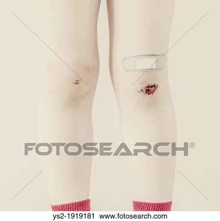 Closeup of the legs of a young child with bruises and bandaid View Large Photo Image Stock Image - Closeup of the legs of a young child with bruises and bandaid. Fotosearch