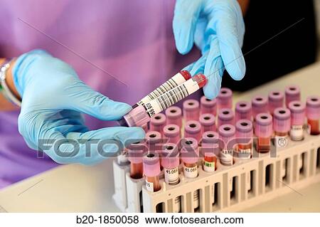 Complete Blood Count CBC or Hemogram, Hemotherapy, Donostia Hospital, San Sebastian, Donostia, Gipuzkoa, Basque Country, Spain View Large Photo Image Stock Photo - Complete Blood Count CBC or Hemogram, Hemotherapy, Donostia Hospital, San Sebastian, Donostia, Gipuzkoa, Basque Country, Spain. Fotosearch