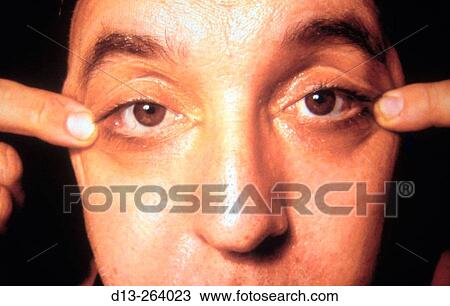 Concept View Large Photo Image Stock Image - Concept. Fotosearch