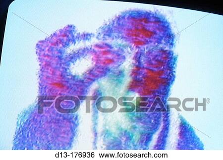Stock Photograph - Concept. Fotosearch