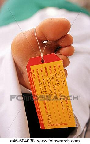 Stock Photo - Corpse. Fotosearch
