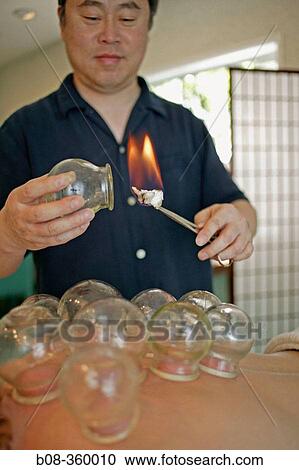 Cupping View Large Photo Image Stock Image - Cupping. Fotosearch