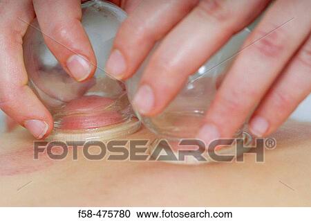 Cupping View Large Photo Image Stock Image - Cupping. Fotosearch