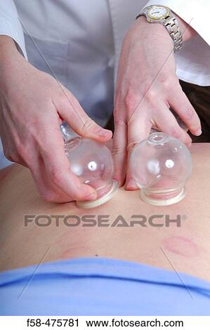 Cupping View Large Photo Image Stock Image - Cupping. Fotosearch