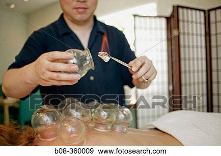 Cupping View Large Photo Image Stock Photo - Cupping. Fotosearch