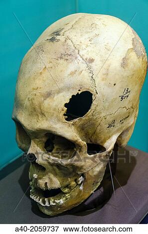 Stock Photo - Deformed skulls of Paracas.. Fotosearch