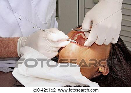 Dentist examining Patient View Large Photo Image Stock Image - Dentist examining Patient. Fotosearch