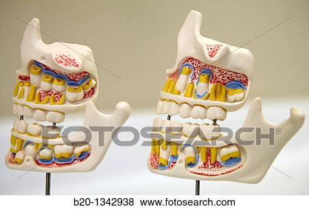 Stock Photo - Dentition model, dental clinic, Eibar, Gipuzkoa, Euskadi, Spain. Fotosearch
