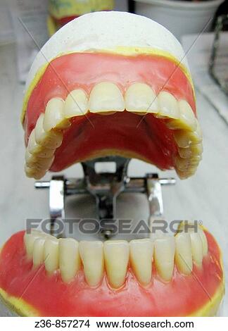 Denture model View Large Photo Image Picture - Denture model. Fotosearch