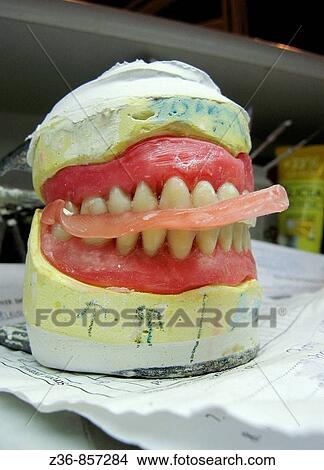 Picture - Denture model. Fotosearch