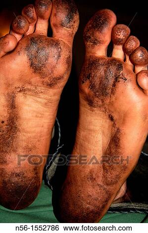 Dirty feet View Large Photo Image Stock Photograph - Dirty feet. Fotosearch