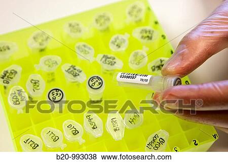 Stock Photo - DNA study, Laboratory of Molecular genetics. Hospital Policlinica Gipuzkoa, San Sebastian, Donostia, Euskadi, Spain. Fotosearch