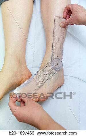 Doctor with goniometer measuring ankle inversion, Physiotherapy medical center, Donostia, San Sebastian, Gipuzkoa, Basque Country, Spain View Large Photo Image Stock Image - Doctor with goniometer measuring ankle inversion, Physiotherapy medical center, Donostia, San Sebastian, Gipuzkoa, Basque Country, Spain. Fotosearch