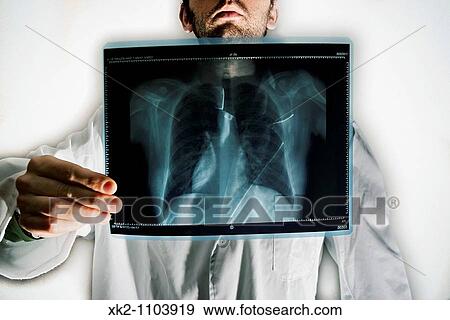 Doctor's x-ray chest View Large Photo Image Stock Photo - Doctor's x-ray chest. Fotosearch