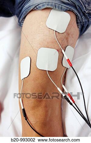 Electrical muscle stimulation, rebahilitation. Policlinica Gipuzkoa, San Sebastian, Donostia, Euskadi, Spain View Large Photo Image Stock Image - Electrical muscle stimulation, rebahilitation. Policlinica Gipuzkoa, San Sebastian, Donostia, Euskadi, Spain. Fotosearch