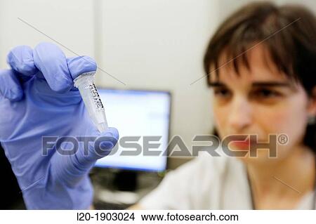 Extraction of DNA from lung tumor biopsies for EGFR gene mutation study for possible treatment with anti-EGFR View Large Photo Image Picture - Extraction of DNA from lung tumor biopsies for EGFR gene mutation study for possible treatment with anti-EGFR. Fotosearch