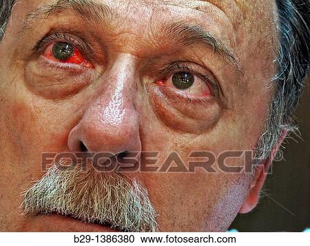 eye View Large Photo Image Stock Image - eye. Fotosearch