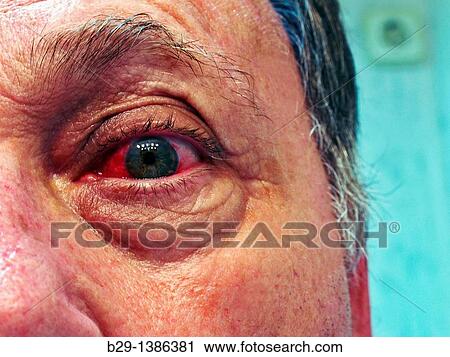 eye View Large Photo Image Stock Image - eye. Fotosearch