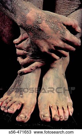 Feet. View Large Photo Image Stock Image - Feet.. Fotosearch