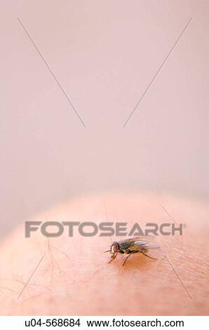 Picture - Fly on human knee. Fotosearch