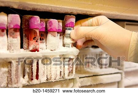 Frozen blood samples, stored samples in refrigerator at -80? C, DNA and RNA biobank, extraction and storage of DNA/RNA from blood samples, Biodonostia Health and Biomedicine Research Institute, San Sebastian, Donostia, Gipuzkoa, Euskadi, Spain View Large Photo Image Stock Image - Frozen blood samples, stored samples in refrigerator at -80? C, DNA and RNA biobank, extraction and storage of DNA/RNA from blood samples, Biodonostia Health and Biomedicine Research Institute, San Sebastian, Donostia, Gipuzkoa, Euskadi, Spain. Fotosearch