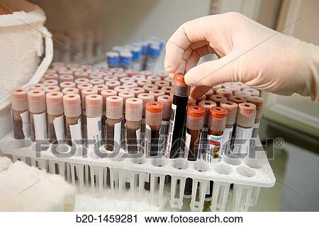 Frozen blood samples, stored samples in refrigerator at -80? C, DNA and RNA biobank, extraction and storage of DNA/RNA from blood samples, Biodonostia Health and Biomedicine Research Institute, San Sebastian, Donostia, Gipuzkoa, Euskadi, Spain View Large Photo Image Stock Image - Frozen blood samples, stored samples in refrigerator at -80? C, DNA and RNA biobank, extraction and storage of DNA/RNA from blood samples, Biodonostia Health and Biomedicine Research Institute, San Sebastian, Donostia, Gipuzkoa, Euskadi, Spain. Fotosearch