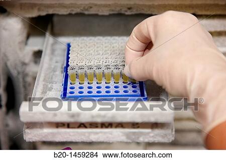 Frozen serum aliquots, stored samples in refrigerator at -80? C, DNA and RNA biobank, extraction and storage of DNA/RNA from blood samples, Biodonostia Health and Biomedicine Research Institute, San Sebastian, Donostia, Gipuzkoa, Euskadi, Spain View Large Photo Image Picture - Frozen serum aliquots, stored samples in refrigerator at -80? C, DNA and RNA biobank, extraction and storage of DNA/RNA from blood samples, Biodonostia Health and Biomedicine Research Institute, San Sebastian, Donostia, Gipuzkoa, Euskadi, Spain. Fotosearch