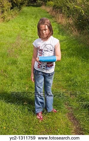 Girl has her arm in a plaster having broken the bone View Large Photo Image Stock Photo - Girl has her arm in a plaster having broken the bone. Fotosearch