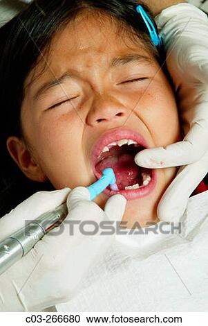 Girl having her teeth cleaned View Large Photo Image Stock Image - Girl having her teeth cleaned. Fotosearch
