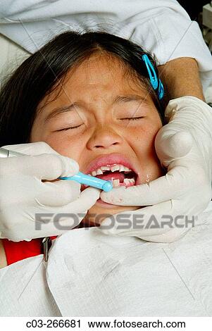 Girl having her teeth cleaned View Large Photo Image Stock Image - Girl having her teeth cleaned. Fotosearch