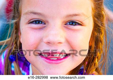 girl missing tooth View Large Photo Image Stock Photo - girl missing tooth. Fotosearch