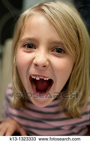 Girl showing his broken tooth View Large Photo Image Stock Image - Girl showing his broken tooth. Fotosearch