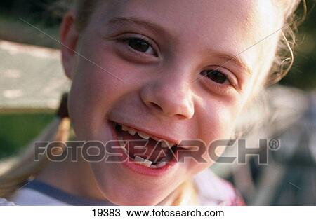 Stock Image - Girl with missing teeth. Fotosearch