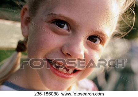 Girl with missing teeth View Large Photo Image Stock Photo - Girl with missing teeth. Fotosearch