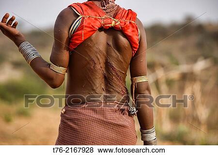 Hamer woman's back after being whipped at a bull jumping ceremony near Turmi in the Omo Valley, Ethiopia. The young women taunt the men into hitting them harder, thinking that if they are strong whippers they will make good husbands!. View Large Photo Image Stock Photo - Hamer woman's back after being whipped at a bull jumping ceremony near Turmi in the Omo Valley, Ethiopia. The young women taunt the men into hitting them harder, thinking that if they are strong whippers they will make good husbands!.. Fotosearch